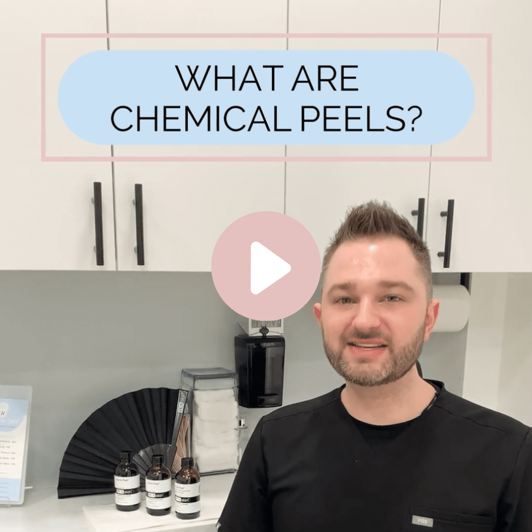 What are Chemical Peels?